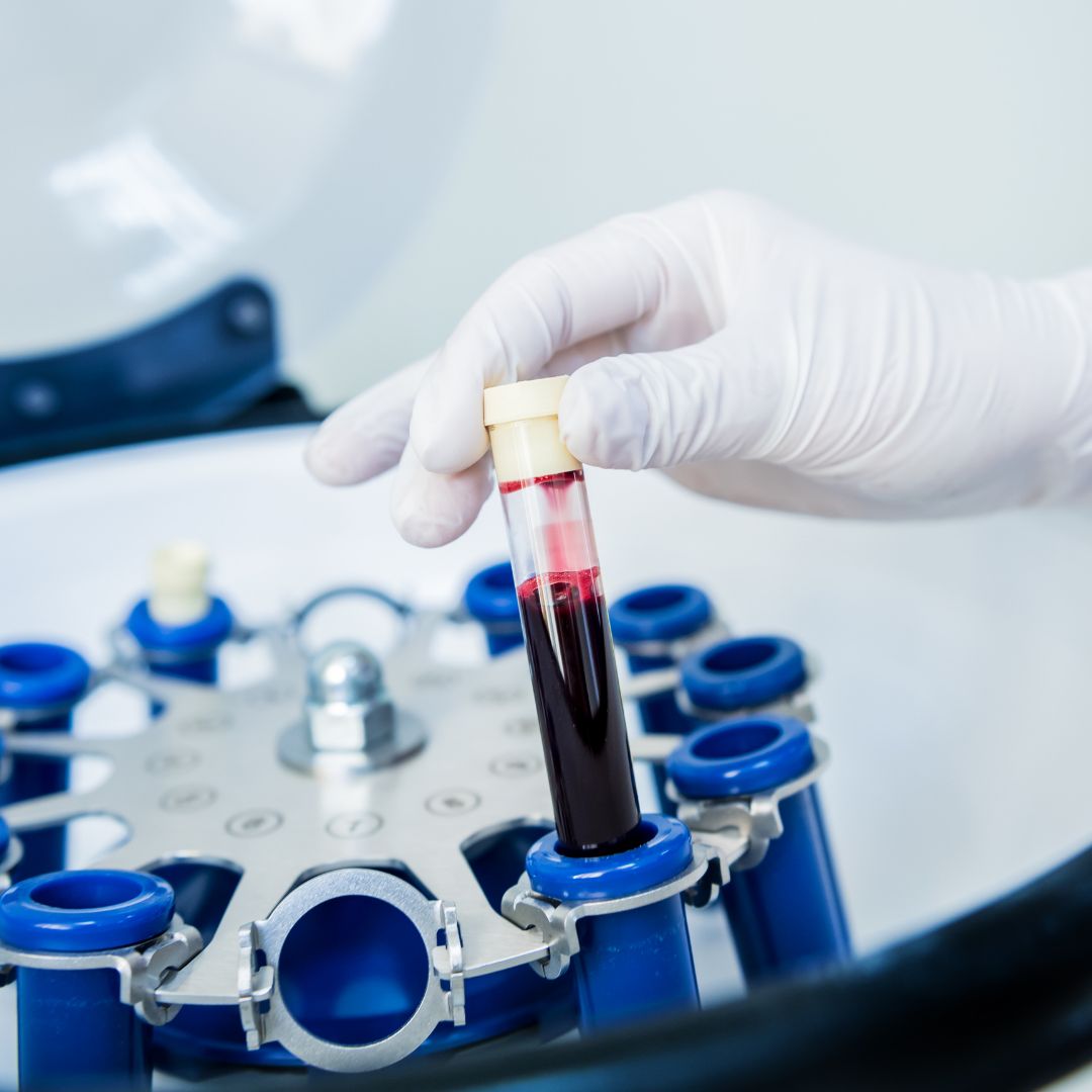 Calibrated Platelet Concentration